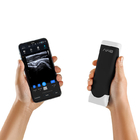 Portable Handheld Wireless Probe Type Ultrasound Scanner 2mhz
