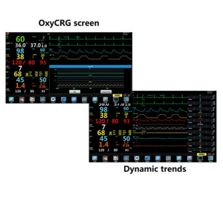 Portable Anaesthetic Monitoring Equipment Oxygen Analyzer TFT 15.6&quot; LCD