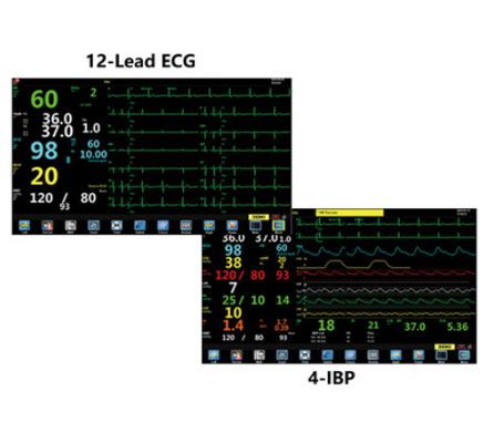 Portable Anaesthetic Monitoring Equipment Oxygen Analyzer TFT 15.6&quot; LCD